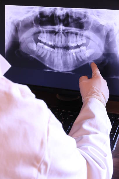 Best Knocked-Out Tooth (Avulsed Tooth) Treatment in Hillsboro, TX